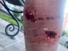 Стая бешеных собак набросилась на девушек в воронежском ЖК – им прокусили ноги