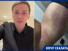 "Спасибо за подарок": воронежец рассказал об избиении  23 февраля
