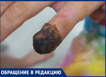  «Девять с половиной пальцев»: девочка лишилась фаланги в Воронеже – кто понесет наказание?