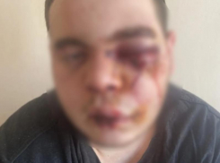 Сотрясение мозга вместо шаурмы получил 23-летний мужчина в Воронежской области