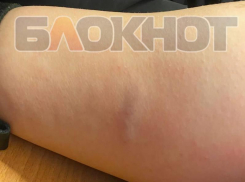  «Будем ждать, пока загрызут?»: собаки накинулись на девушку в частном секторе Воронежа 