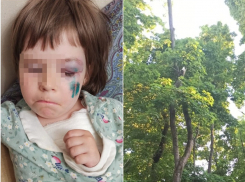 Придется платить: падение дерева на девочку в воронежском парке хотели свалить на ветер   