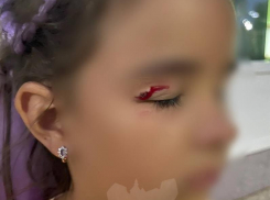 Напоролась глазом: о травмировании ребенка на детской площадки сообщили в Воронеже