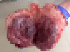 Сильная боль внизу живота привела к срочной операции в Воронеже