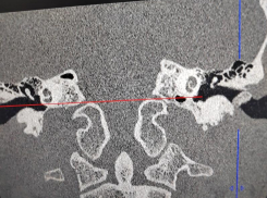 Ребенка с редкой патологией прооперировали воронежские врачи