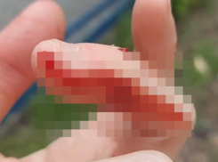 Девушка сообщила, что ее покусала женщина-прохожая в Воронеже 