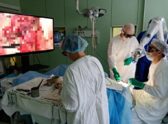 Воронежские врачи провели с уникальным прибором первую операцию на головном мозге  