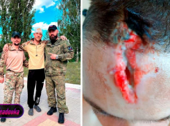 Воронежец головой отбил дрон-камикадзе 