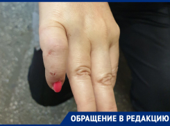 Жительница Воронежа попала в яму-ловушку и сломала палец 