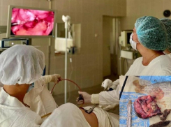 Кисту в 12 сантиметров удалили у женщины воронежские врачи