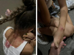 Стало известно, кто сбил 8-летнюю девочку на электросамокате в Воронеже 