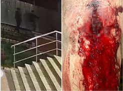 Воронежца расстреляли из «травмата» за комментарий в соцсетях