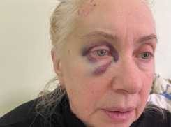 Неадекватный мужчина ворвался в палату и покусал пациентку ковидного отделения в Воронеже