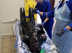 Павловские врачи впервые столкнулись с пациентом, упавшим в битумную реку