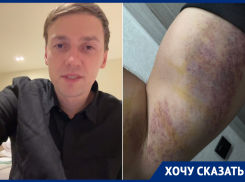 «Спасибо за подарок»: воронежец рассказал об избиении  23 февраля