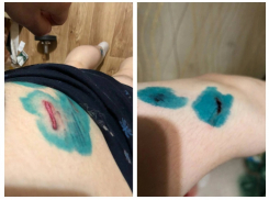 Стая из пяти агрессивных собак набросилась на воронежца и злостно покусала его за попу 