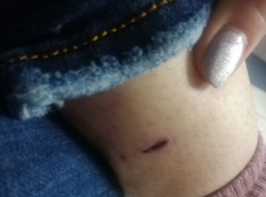 Стая агрессивных собак держит в страхе жителей улицы Еремеева в Воронеже