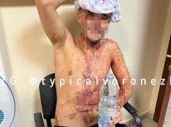 Воронежец ударил соседа кухонным топориком по голове 