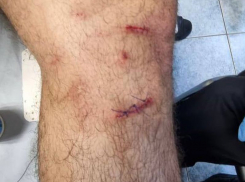 После игры с «Уралом» капитану воронежского «Факела» Квеквескири наложили швы