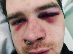 Под Воронежем молодого отца зверски избили на глазах у его детей