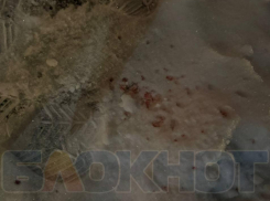 «Ему оказывают помощь»: минздрав рассказал о состоянии пенсионера, избитого битами в Воронеже