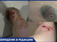«Я вас всех расстреляю»: беременную девушку искусали псы хозяина с ружьем в Воронежской области