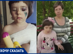 «Каждая вторая ветка – потенциальный убийца»: дерево рухнуло на пятилетнюю девочку в воронежском парке 