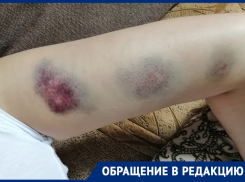  Мать двоих детей получила синяки после встречи с полицейским в Воронежской области 