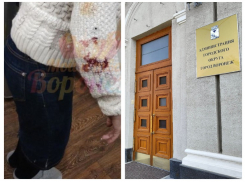 Жестокое нападение стаи собак на женщину привело к уголовному делу в Воронеже