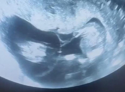 Неожиданно радостную новость сообщили врачи беременной с жалобами в Воронеже 