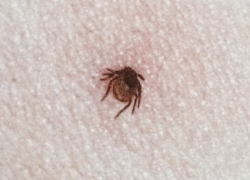 Более полутора тысяч воронежцев укусили клещи в этом году