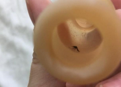 Мертвое насекомое в соске получила молодая мама в воронежской больнице