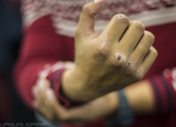 Многодетная мать вместе с 16-летним братом жестоко избили женщину-полицейского в Воронеже