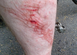 Бездомная собака покусала велосипедиста в воронежском «Олимпике» 