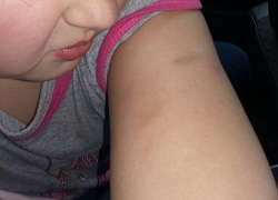 "Дети кричали, ты - жирная!" - как лицеисты жестоко издевались над маленькой девочкой в Воронеже