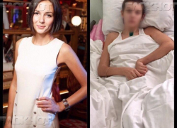 Пострадавшей в жуткой аварии на воронежском водохранилище девушке собрали около млн рублей на лечение