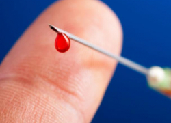 74 воронежца заразились вирусом «ласкового убийцы» за год