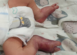 Следователи разберутся в деле домашних родов под Воронежем