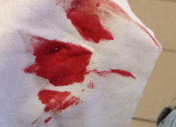 «Чудом выжил»: воронежца жестоко избили в собственной квартире 