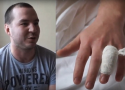 Активисту «Единой России» сделали прививку от укуса воронежских сторонников Навального