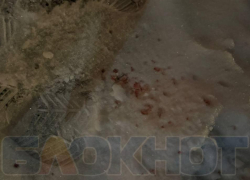 «Ему оказывают помощь»: минздрав рассказал о состоянии пенсионера, избитого битами в Воронеже