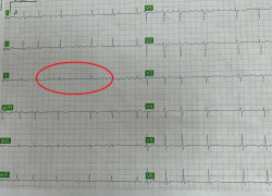 Супруга уговорила мужа лечь в больницу и предотвратила трагедию в Воронеже