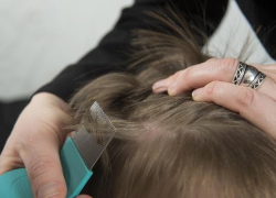 Стало известно, у скольких учеников воронежской школы нашли вшей