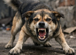 Прокуратура потребовала деньги с воронежских чиновников за нападение собаки на 11-летнего ребенка 