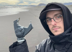 Воронежский блогер, лишившийся рук из-за петарды, встал на голову в новом обращении