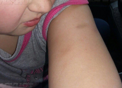 СК заинтересовался ситуацией с жестокими издевательствами лицеистов над 9-летней девочкой в Воронеже