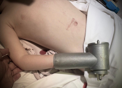 Трехлетний малыш заснул руку в электромясорубку в Воронеже 