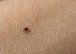 Воронежцев подстерегают очаговые инфекции 