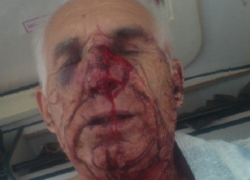 В Воронеже жестоко избили гражданского активиста