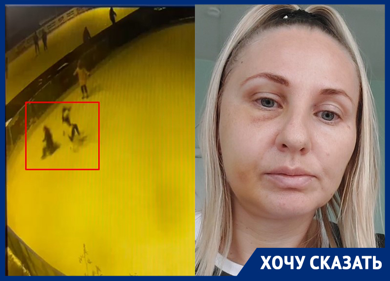 Перелом черепа и повреждение лицевого нерва: жительница Воронежа рассказала об «ужасном событии» на катке